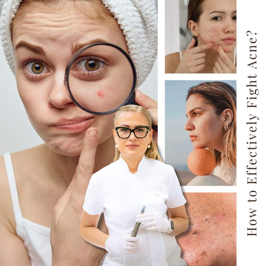 acne specialist, corby